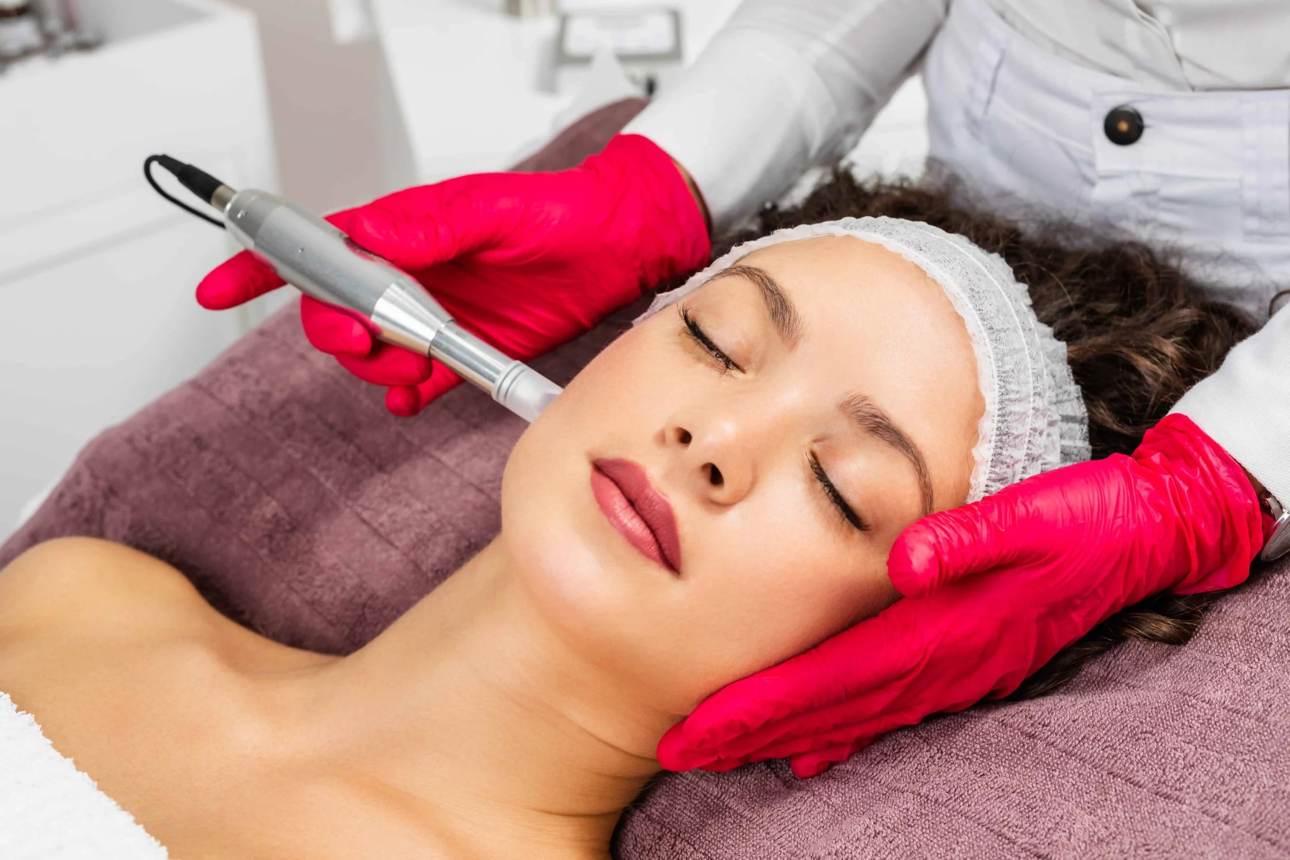 Microneedling treatment
