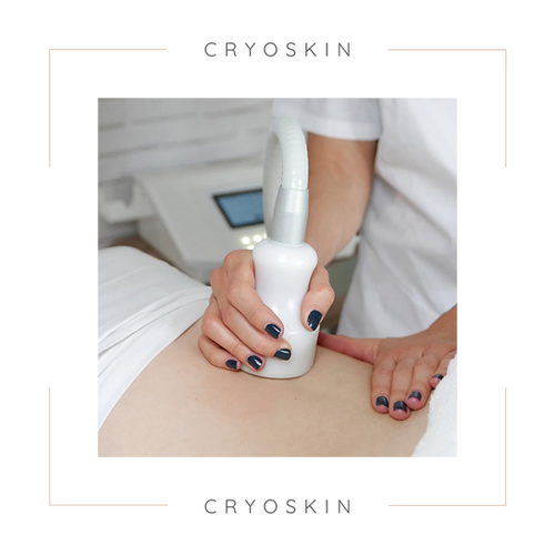 CryoSkin Treatment at Marco Med in Corona, CA